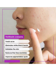 ACRETIN 0.05% CREAM FOR ACNE TREATMENT, 30G (JAMJOOM PHARMA)