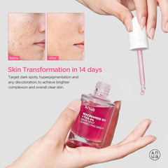 Anua Niacinamide 10% + TXA 4% Dark Spot Serum. 30ml