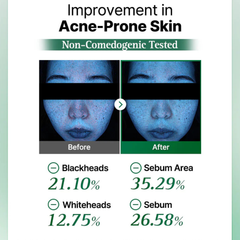 COSRX One Step Original Clear Skin Calming Pad