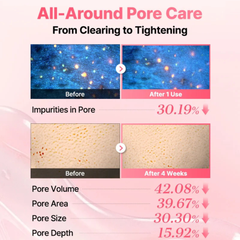 COSRX Red Rice Inositol Exfoliating Care Pore Peel Serum
