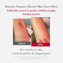Medicube Red Acne Body Peeling Shot Toner - 110g