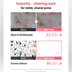 COSRX Red Rice Inositol Exfoliating Care Pore Peel Serum