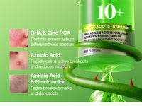 Anua Azelaic Acid 10 Hyaluron Redness Soothing Serum - 30ml | korea