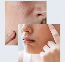Anua Birch 70% Moisture Boosting Serum Korea